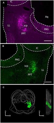 Cholinergic Projections From the Pedunculopontine Tegmental Nucleus Contact Excitatory and Inhibitory Neurons in the Inferior Colliculus